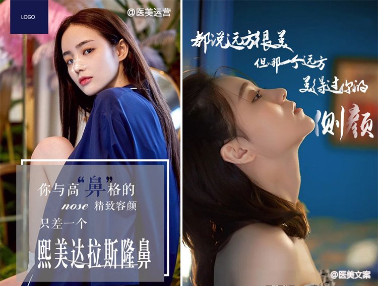 隆鼻医美文案 (图2)